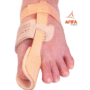 Hallux Valgus Splint Price in Pakistan